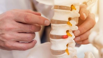 Chiropraxie